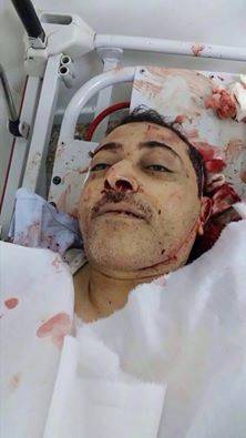 المؤتمر والاشتراكي يدينان حادثة اغتيال الصحفي عبدالكريم الخيواني
